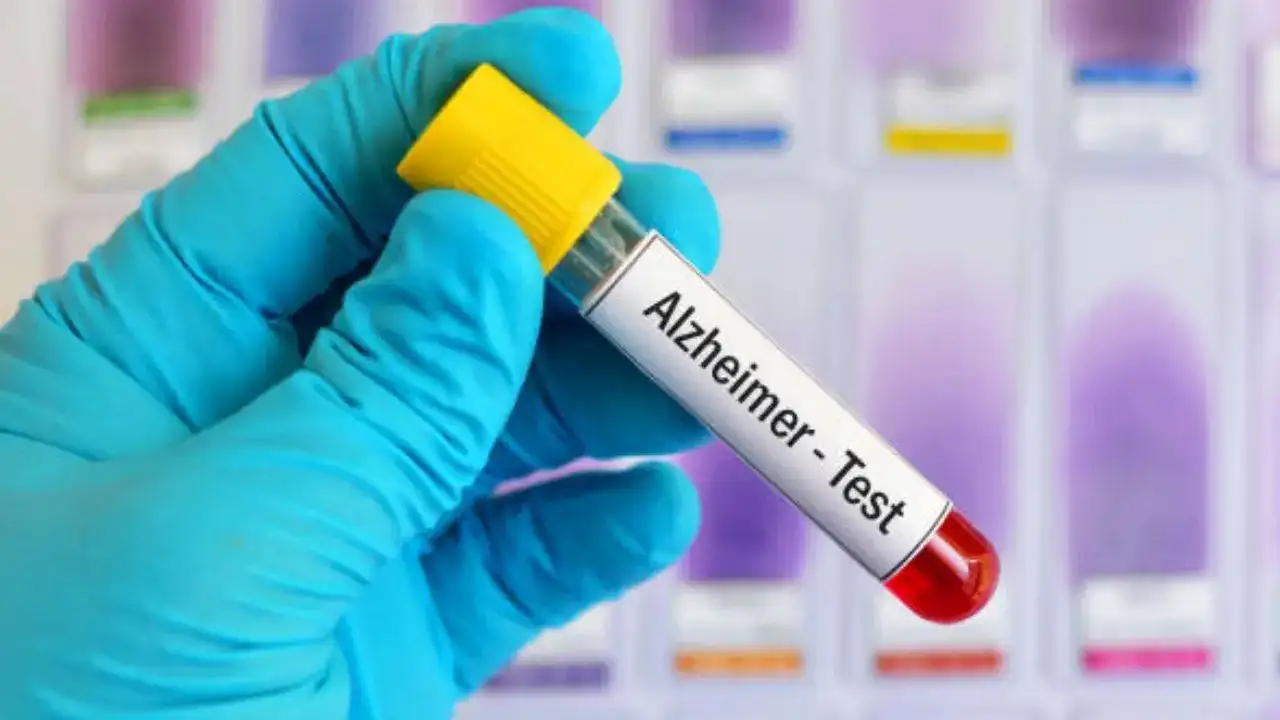 FDA-მა ალცჰაიმერის დიაგნოსტიკისთვის სისხლის პირველი ტესტი დაამტკიცა